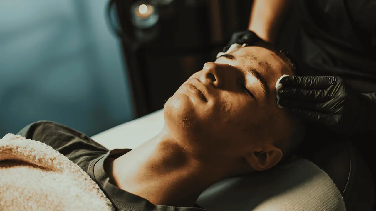 Terapia trądzikowa – Mento Care Bochnia